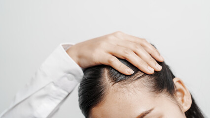 Close up young asian chinese woman with hair loss problem, dandruff and itchy scalp problems.