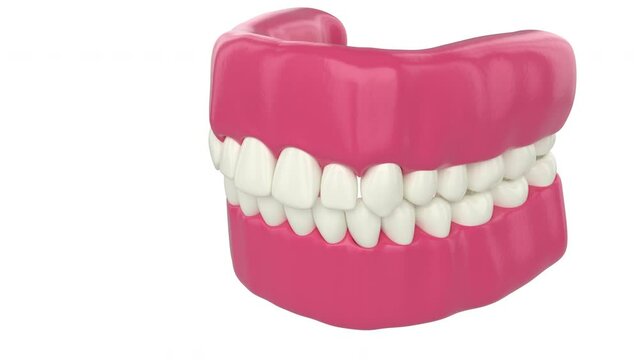 Crowded teeth, abnormal dental occlusion. 3D illustration for medically accurate teeth