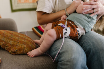 Mother with a baby who needs food through the tube