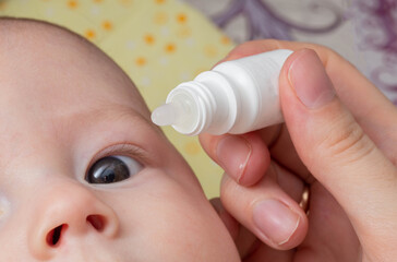 Instillation of medicinal drops in the eye of a child to treat conjunctivitis and blockage of the...