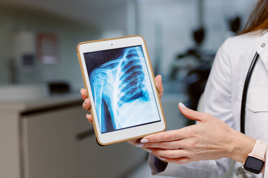 Tablet display chest radiography digital anatomy health 