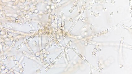 Neurospora sp. under microscope. Sample collected from corncob. Fresh sample without staining....
