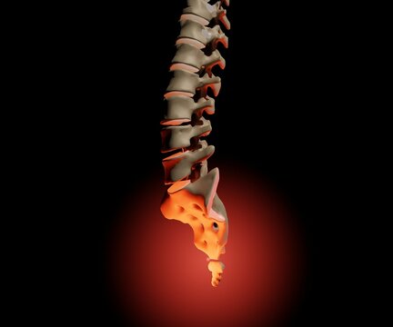 Isolated human's tailbone pain, called coccydynia 3d rendering