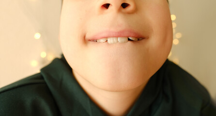closeup crooked teeth, boy 9-10 years opened mouth, child 8 years old shows teeth, visit to dentist...