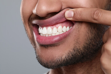 Man showing healthy gums on grey background, closeup - obrazy, fototapety, plakaty
