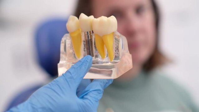 dental implants, dentist discussing a treatment plan with patient holds a dental implant model, emphasizing the importance of patient education in modern dental clinics. 