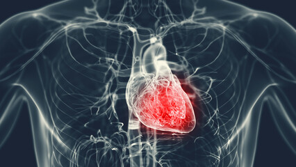 3d medical illustration of a man's inflamed heart - 594033162