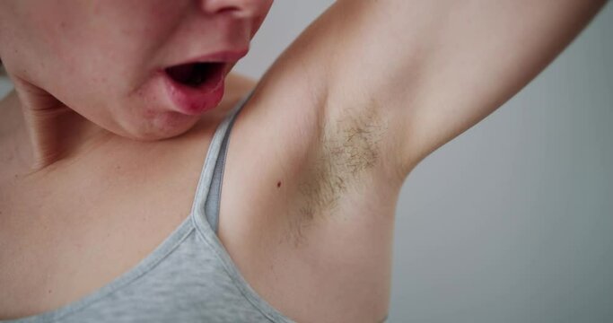 Young Woman With Hairy Armpit. Hair Removal