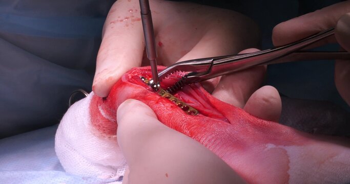 In the operating room, a veterinary surgeon attaches a titanium plate to a broken bone in a pet's paw with screws. A team of veterinarians performs surgery on a pet with a broken paw.
