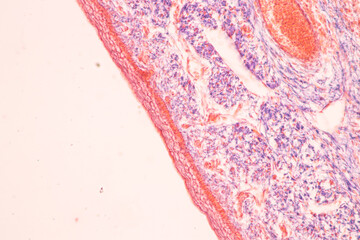 Anatomy and Histological Bone, Elastic cartilage human and Joint of human foetus under the...