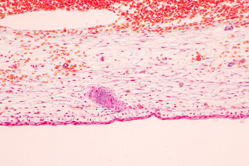 Anatomy and Histological Bone, Elastic cartilage human and Joint of human foetus under the...