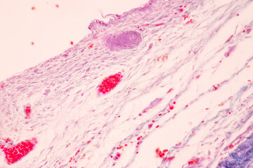 Anatomy and Histological Bone, Elastic cartilage human and Joint of human foetus under the...