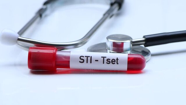 STI test to look for abnormalities from blood,  blood sample to analyze in the laboratory, blood in test tube