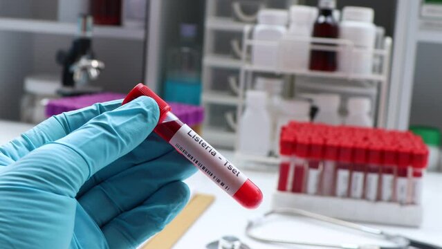 Listeria test to look for abnormalities from blood,  blood sample to analyze in the laboratory, blood in test tube
