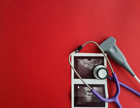 Ultrasound transducer ultrasonic machine and x-ray of pregnancy and uterus