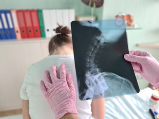 Pediatrician doctor examines x-ray of child spinal deformity