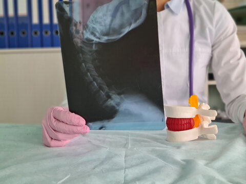 Doctor examines x-ray of neck and spine