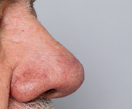 close up of a  old man nose