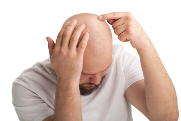 Young man hair loss problem for health care shampoo