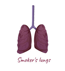 Concept Human anatomy organ smokers lungs. This illustration features a flat, vector design of the anatomy of the lungs of a smoker, depicted in a cartoon style. Vector illustration.