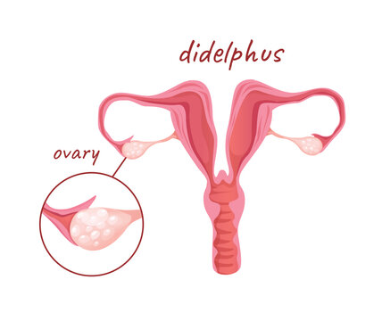 Concept Female anatomy uterus didelphus. The illustration is a flat, vector, cartoon-style design of the anatomy of the female reproductive system, with a focus on the uterus. Vector illustration.