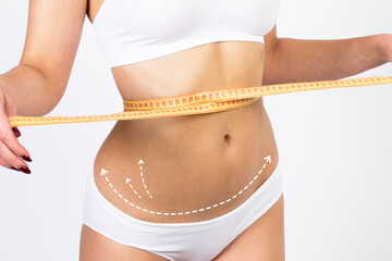 Cellulite removal on body girl. Woman with meter, body care cosmetic concept. Plastic surgery concept. - 594344393