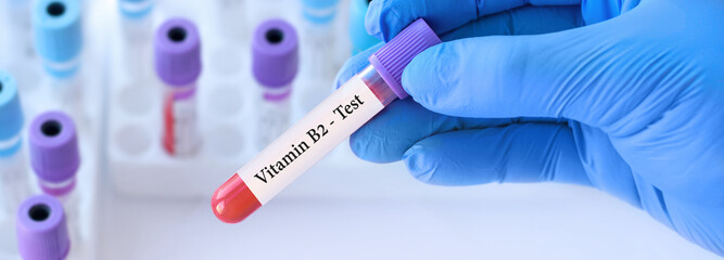 Doctor holding a test blood sample tube with Vitamin B2 test on the background of medical test tubes with analyzes. Banner