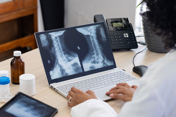 Biracial female doctor using laptop with radiograph on screen at doctor's office