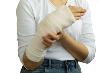 A woman with a broken arm in a plaster cast  isolated transparent png. Health insurance concept.