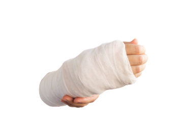 Close-up of a broken arm of a woman in a cast isolated transparent png.