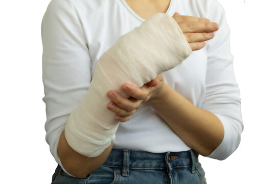 A woman with a broken arm in a plaster cast  isolated transparent png. Health insurance concept.