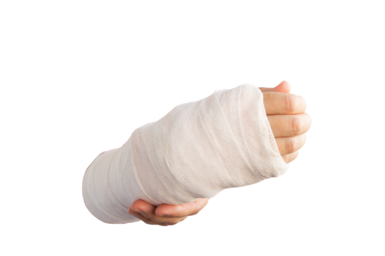 Close-up of a broken arm of a woman in a cast isolated transparent png.