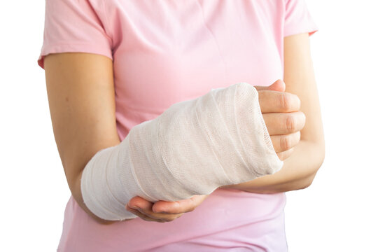 Close-up of a broken arm of a woman in a cast in a pink t-shirt on a isolated transparent png. Accident insurance.