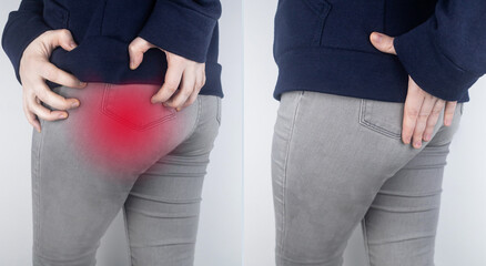 Before and after. A woman suffers from pain in the buttock. The doctor diagnoses the patient...