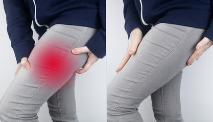 Before and after. On left, a woman has acute pain in the hip after a muscle strain or tear. On...