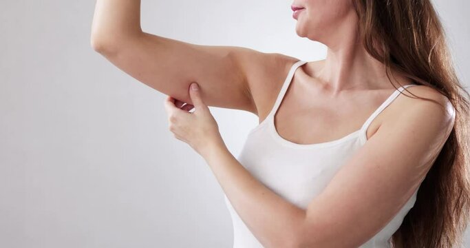 Women Testing Arm Fat Before Liposuction