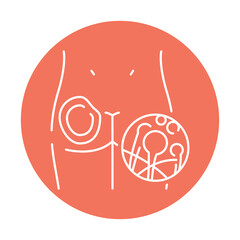 Cutaneous mucormycosis color line icon. Human diseases.