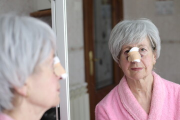 Senior woman recovering after a nose job 