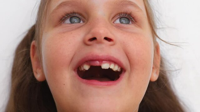Satisfied, surprised small little blond girl with blue eyes covering toothless mouth, look up with relief on white background. Finally, tooth is out. Tooth extract and milk temporary teeth treatment