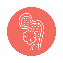 Systemic Lupus Erythematosus color line icon. Pictogram for web page