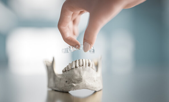 The woman is putting a transparent orthodontic aligner on a cast of teeth using her hand. The plastic form is used for adjusting teeth