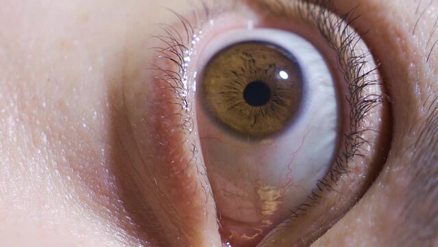 Vertical Video of Close-up eye. The eyes of the mentally ill man.
The madman opens his eyes and looks around and the iris gets smaller or bigger.
