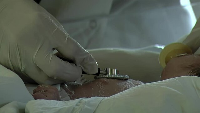 Doctor Examining Premature Baby With Stethoscope At Neonatal Intensive Care Unit In Hospital. Close Up.