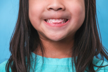 Smiling cute little girl eating sweet gelatin with sugar added isolated on blue background. Children eat sugary sweets, causing loss teeth or tooth decay and unhealthy oral care.