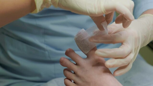 Bandaging of the finger after removal of an ingrown nail. Podology, medicine and nail care