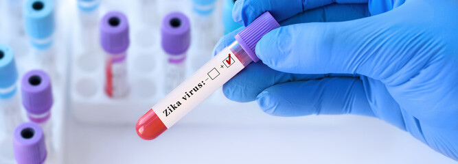 Naklejka premium Doctor holding a test blood sample tube positive with Zika virus test on the background of medical test tubes with analyzes. Banner