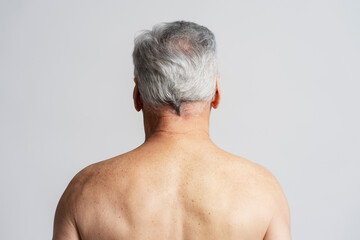 Back view of man with gray hair isolated on gray background. Hair loss problem, hair care