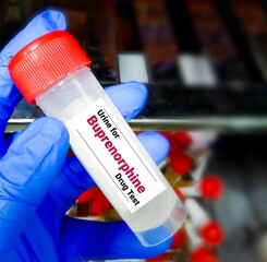 Urine sample for Buprenorphine drug test, is an opioid used to treat severe chronic pain and opioid...