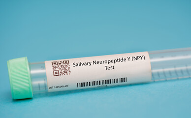 Salivary Neuropeptide Y (NPY) Test