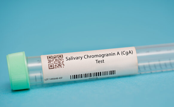 Salivary Chromogranin A (CgA) Test